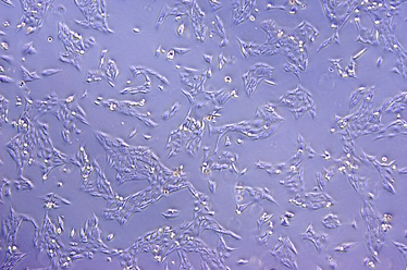 FOXR2 produzierende Neuroblastom-Zellen einer Zelllinie. Bild: F. Schmitt-Hoffner/KiTZ