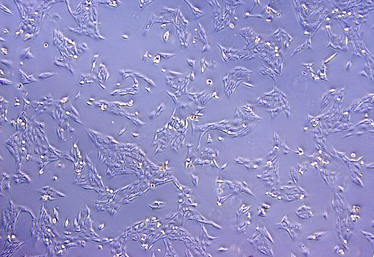 FOXR2-producing neuroblastoma cells of a cell line