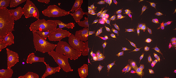 Beispiel Färbung von Medulloblastomzellen (links) und Neuroblastomzellen (rechts), Höchst(blau), CellMask (rot), Lysotracker (gelb).