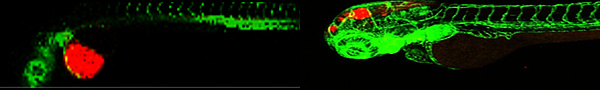 Fili:EGFP zebrafish early larvae, 72hpf, bearing human pediatric cancer cells (red) 
