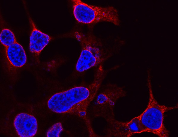 Mikroskopiebild von Zellen, in denen eine veränderte Form des Fusionsproteins C11orf95-RELA eingeschleust wurde