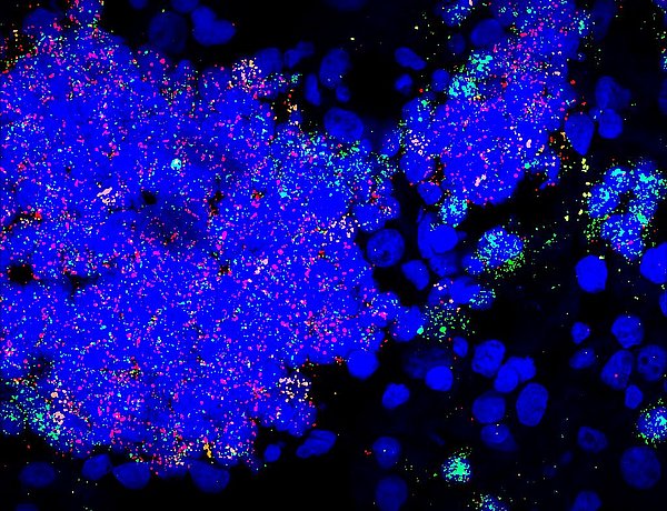 In rot, grün und blau sieht man Nester aus Vorläuferzellen des Neuroblastoms in der Nebenniere. Bild: S. Jansky/KiTZ.