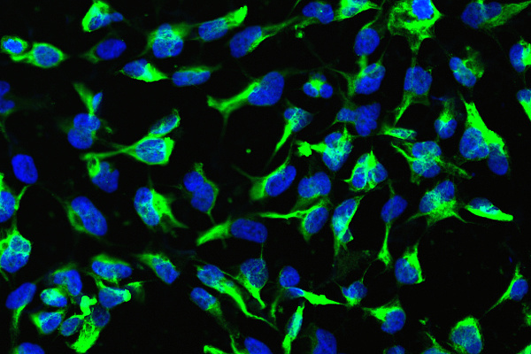 Neurale Stammzellen generiert aus modifizierten humanen induzierten pluripotenten Stammzellen.