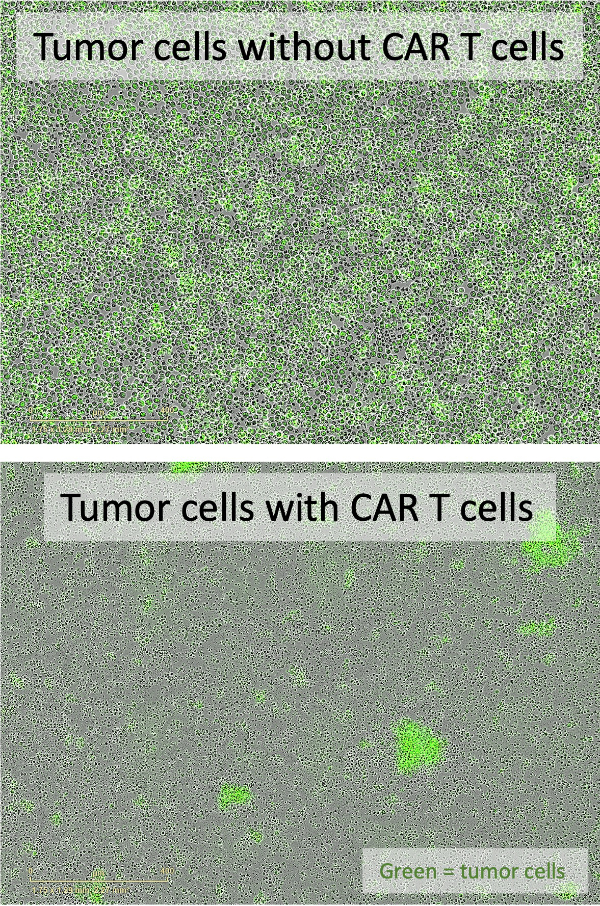 Copyright: Kathleen Grüter/ KiTZ